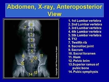 Low Back Pain-Approach to the patient in the E D