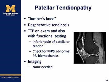 Running Injuries-Evaluation Treatment Prevention