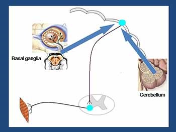 Parkinsons disease-The basics