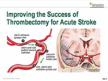 What’s New in Neurology-Recent Discoveries
