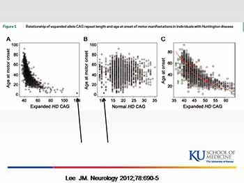 When does Huntingtons Disease Begin