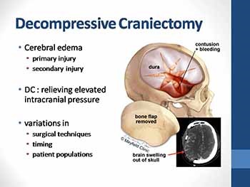 Guidelines for the Management of Severe Traumatic Brain Injury