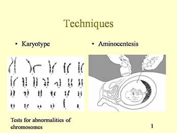 Genetic Counseling