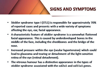 Stickler Syndrome