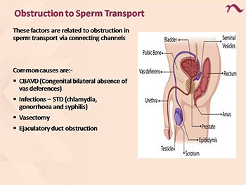 Evaluation and Management of Male Infertility