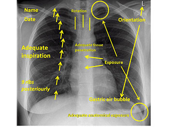 X RAY Interpretation