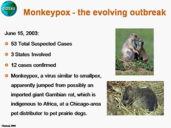 Monkeypox Outbreak in the US