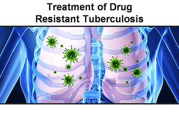 Treatment of Drug-Resistant Tuberculosis