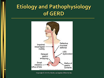 GERD Case Study