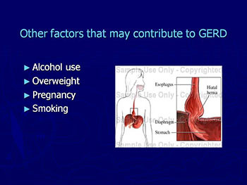 GERD and Its Supraesophageal or Extraesophageal Manafestations