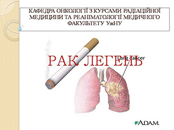 Lung Cancer