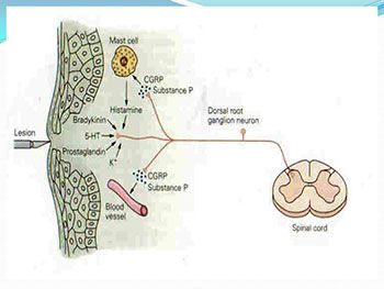 Pain Management in Nursing