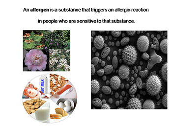 Allergic Diseases-Oral manifestations