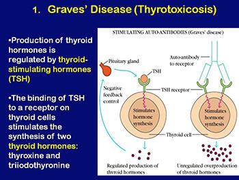 Autoimmune Diseases