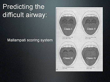 Procedural Sedation