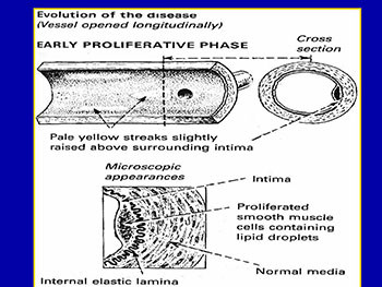 Disease of the Cardiac-Vascular System