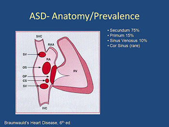 Congenital Hear Disease in Adolescents and Adults