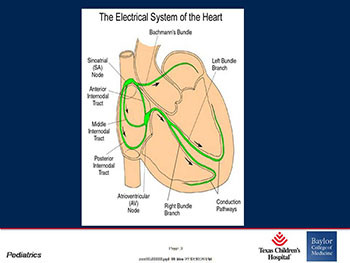 Antiarrhythmic Medications