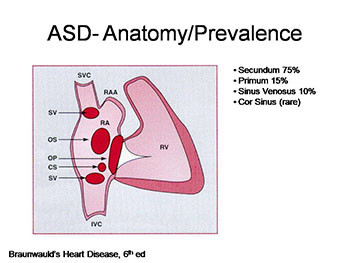 Adult Congenital Heart Disease