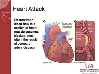 Heart Disease-Are You at Risk