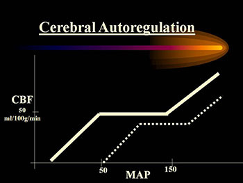 Hypertensive Emergencies