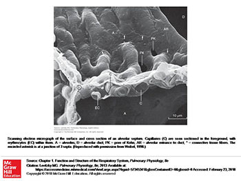 Pulmonary Complications of Congenital Heart Disease 