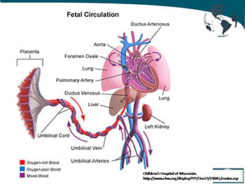 Pulmonary Hypertension in Congenital Heart Disease 