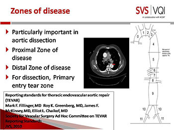 Educational Session on Tevar-Complex Evar in the VQI 