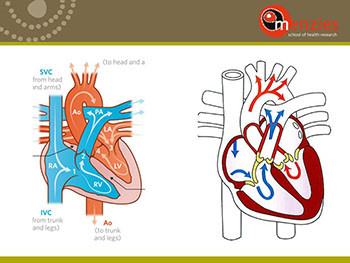 Diagnosis and treatment RHD 