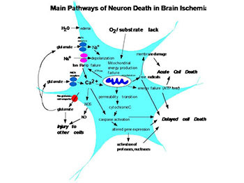 Neuroprotection for Surgery-Is it Possible