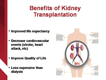 Kidney Transplantation 