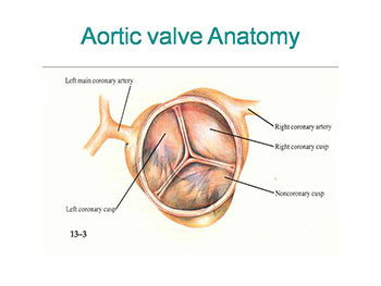 Valve Surgery