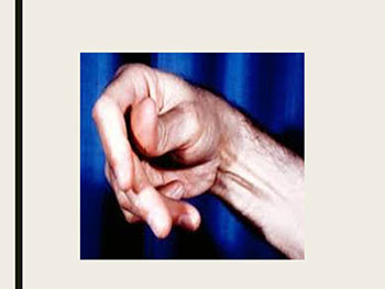 Myopathy