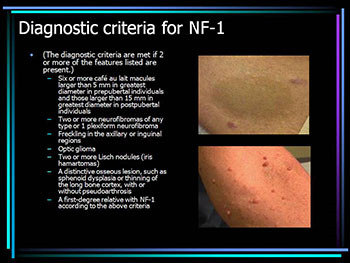 Neurofibromatosis