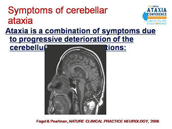 Newly Diagnosed Ataxia