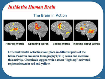 Alzheimers Disease-Unraveling the Mystery