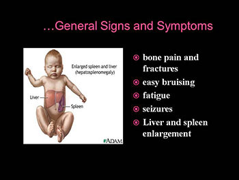 Genetic Disorders