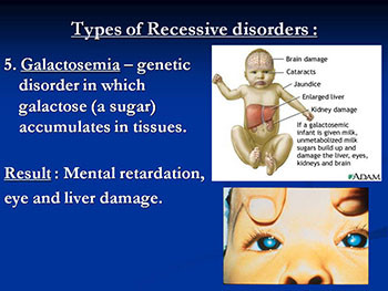 Human Heredity and Sex-Linked Disorders