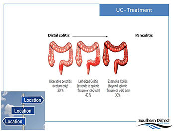 Inflammatory Bowel Diseases