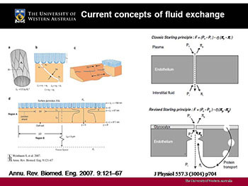 Fluids In Sepsis-Evidence And Cost