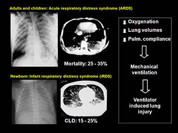 Lower Airway Disease In Children and Neonates