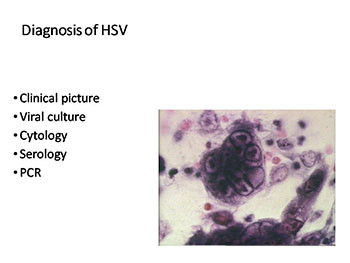 Human Herpes Viruses-HHV