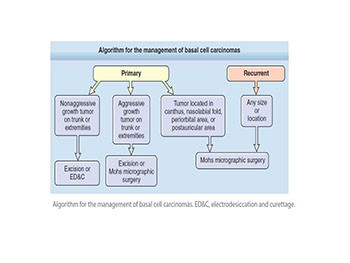 Malignant Skin Tumors