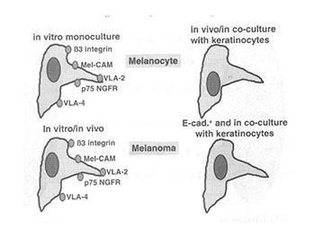 Controversies in Melanoma