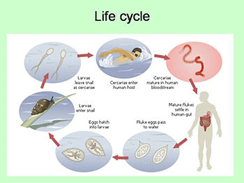 Schistosomiasis