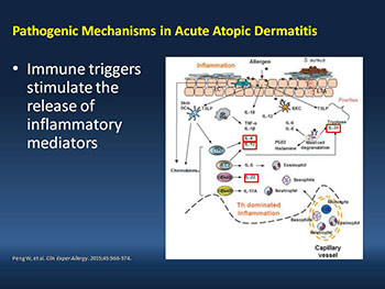 Emerging Treatments in Moderate to Severe Atopic Dermatitis