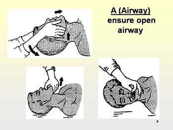 Cardiopulmonary Resuscitation