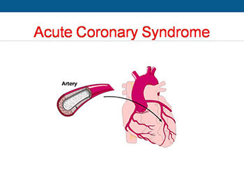 Acute Coronary Syndrome