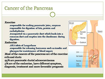 Pancreatic Cancer-Case Presentation