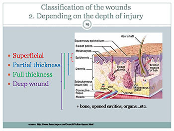 Classification and management of wound principle of wound healing haemorrhage and bleeding control